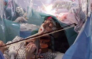 Mulher toca violino durante cirurgia no cérebro