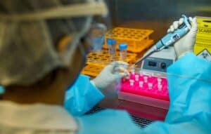 Quando é recomendável fazer um teste para diagnosticar a covid-19?
