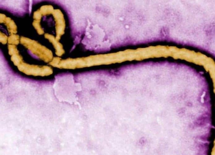 vírus do ebola