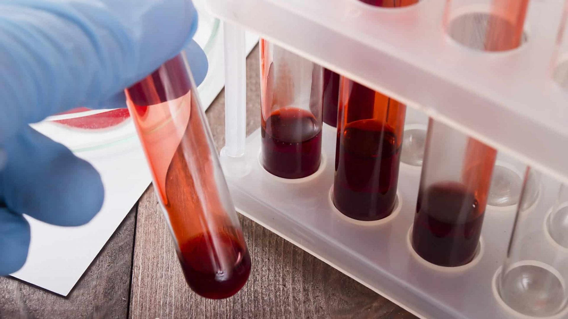 Frascos com amostras de sangue