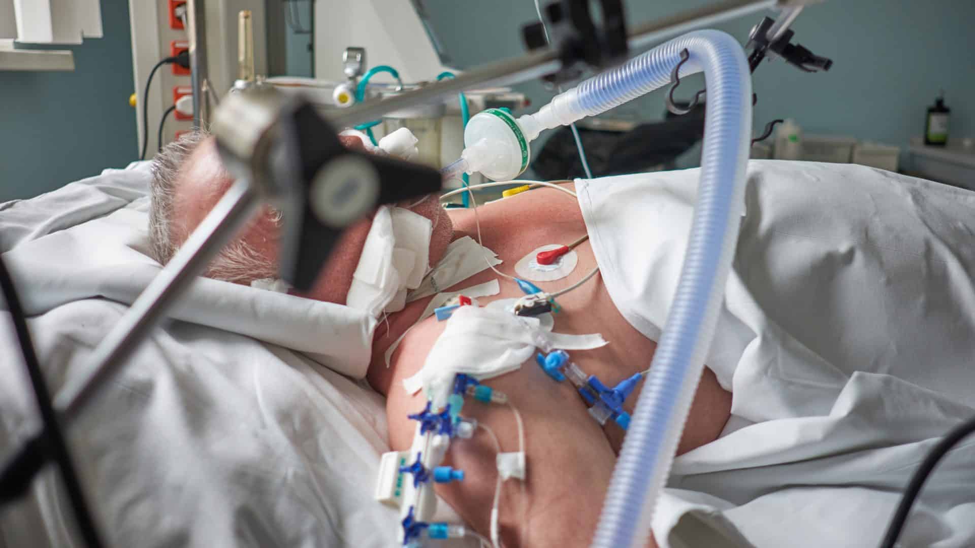 Obesidade agrava risco de intubação