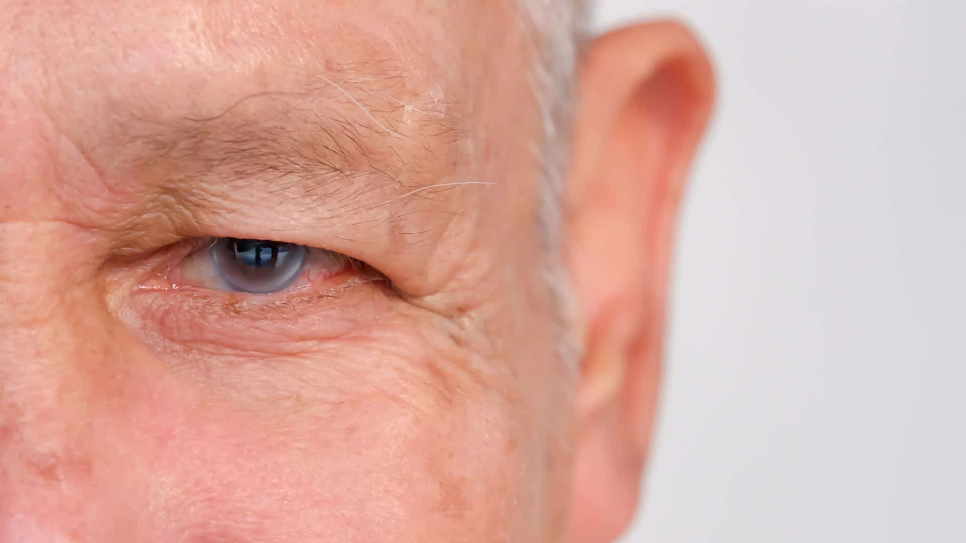 Glaucoma-1920x1080