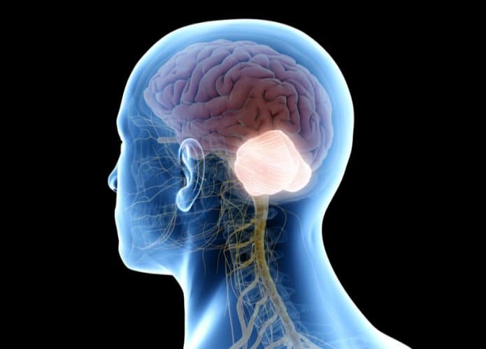 Meduloblastoma-695x500