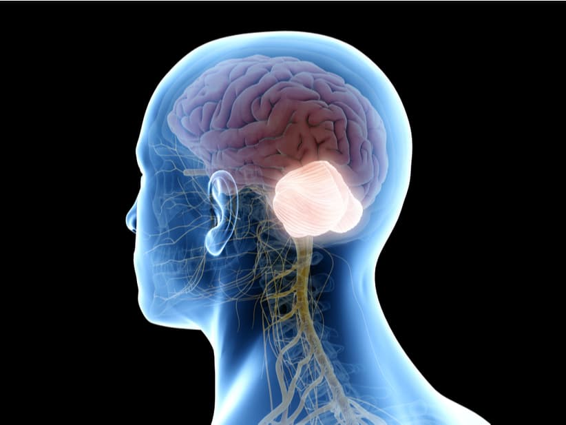 Meduloblastoma