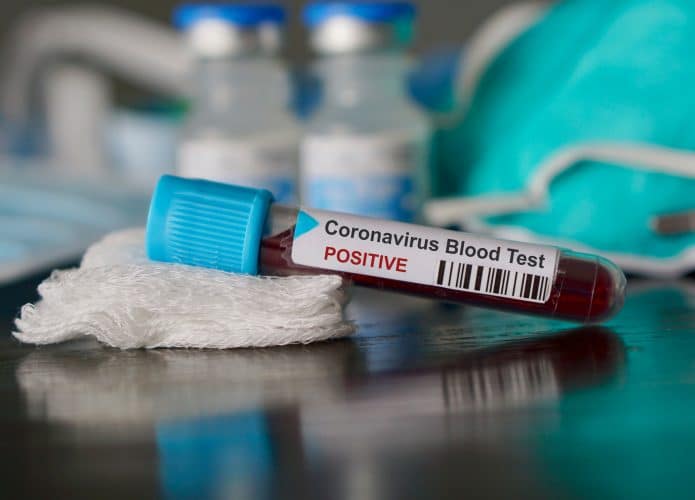 Coronavirus-1-695x500