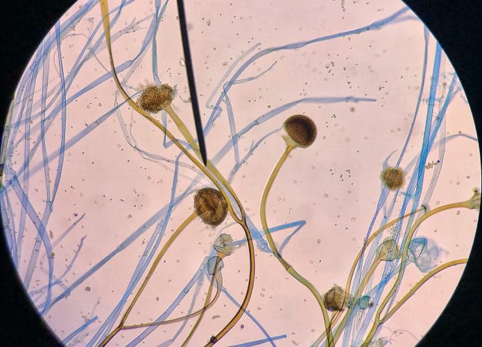 Fungo 'Rhizopus Oryzae' visto em microscópico