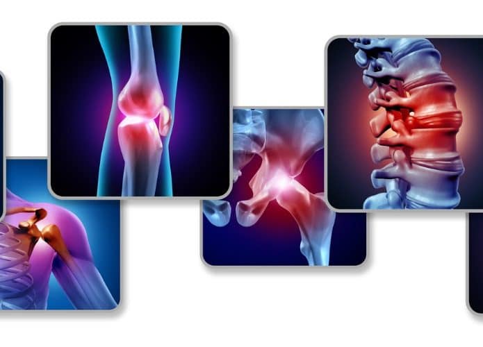 pain-of-the-joints-picture-id1171639646-695x500