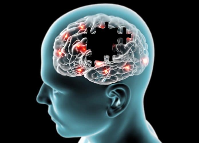 Representação gráfica de doenças degenerativas cerebrais