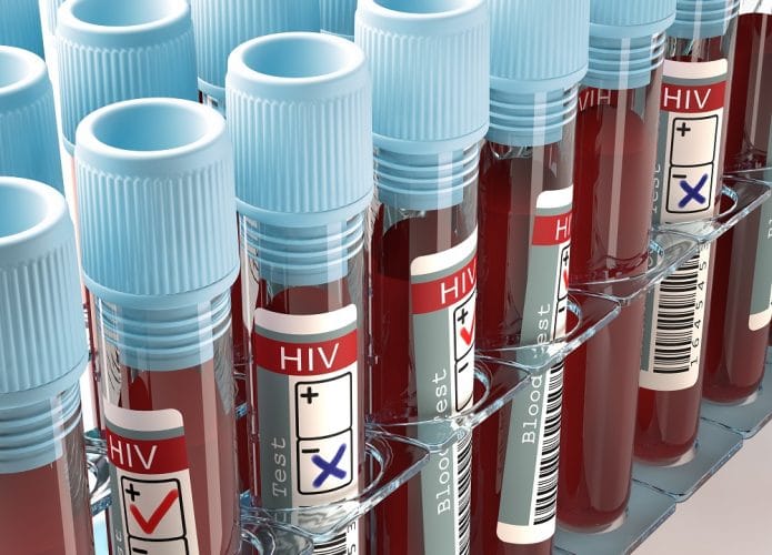 Imagem mostra ampolas de coleta de sangue, com etiquetas nas quais está escrito HIV