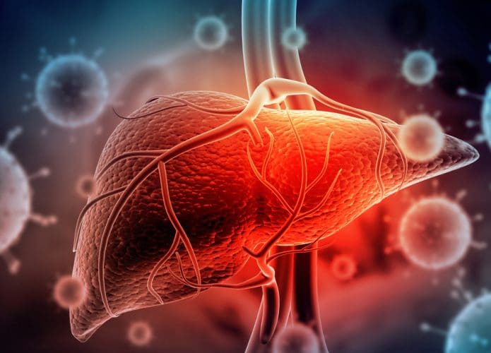 Ilustração 3D de um fígado atingido pela hepatite C
