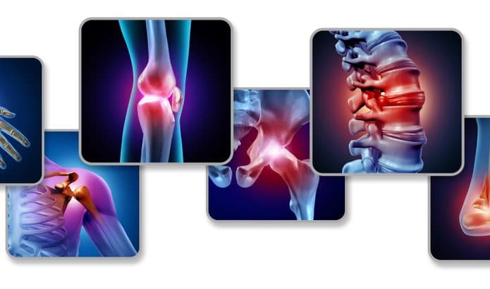 Imagens 3D dos sisntomas da fibromialgia