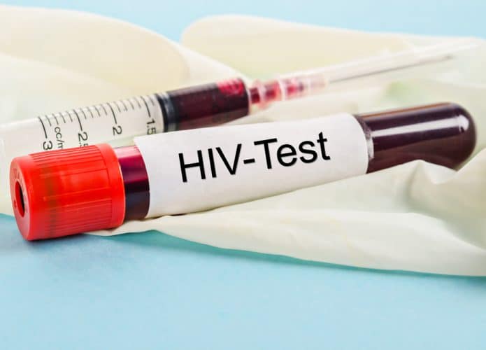 Tubo de ensaio HIV positivo