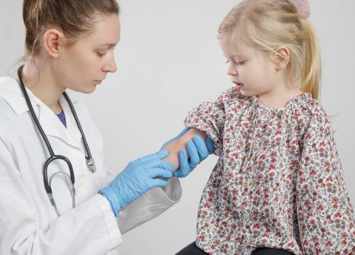 médica avaliando criança com alergia