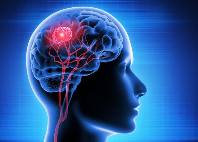Usado para Covid-19, teste de PCR Digital pode identificar mutação em tumor