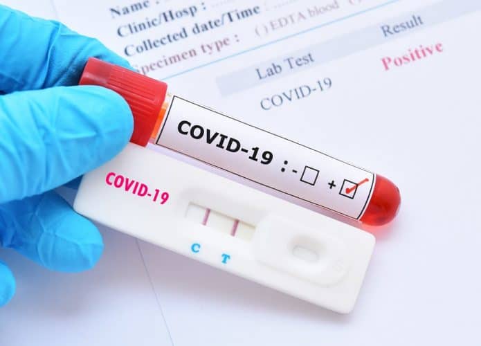 covid-19 américa latina