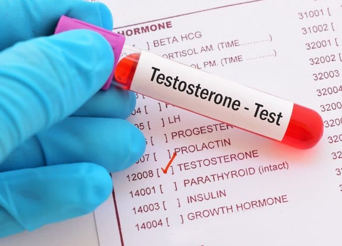 médico segura teste de testosterona