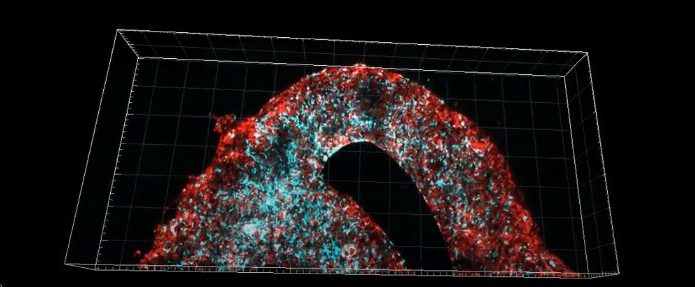 tumor-cerebral-bioimpresso-em-3D-695x287