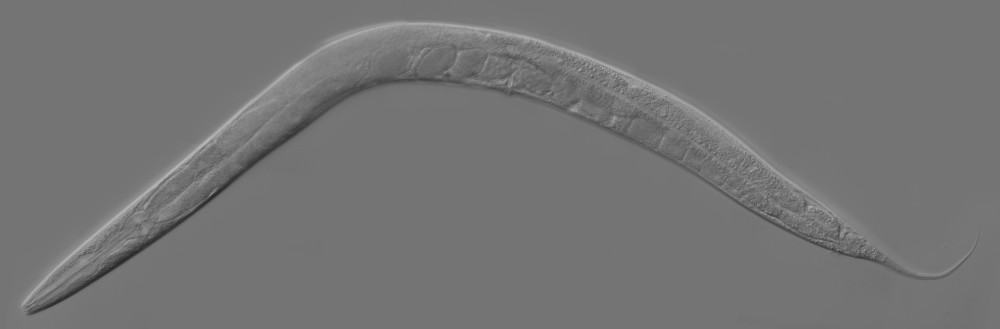 Imagem mostra a Caenorhabditis elegans, um tipo de minhoca que "sente" o som, vista em um microscópio