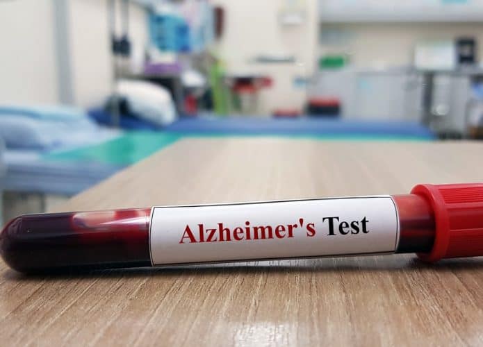 frasco com sangue para exame de Alzheimer