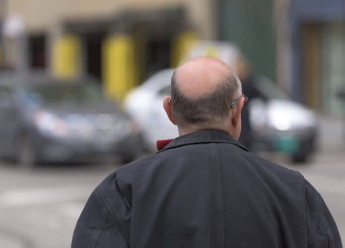 Homem careca visto de costas
