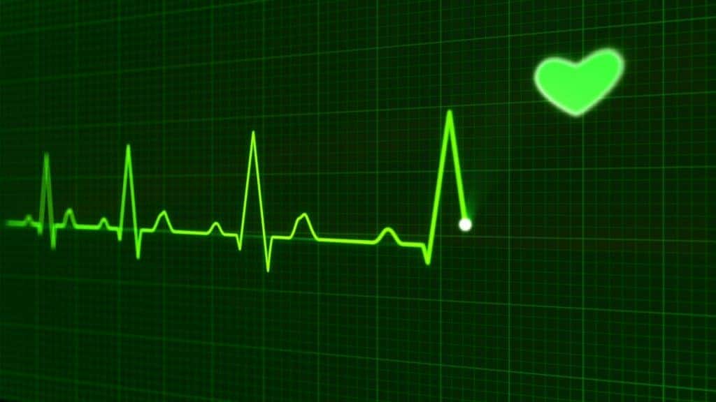 Tela com resultados de um eletrocardiograma