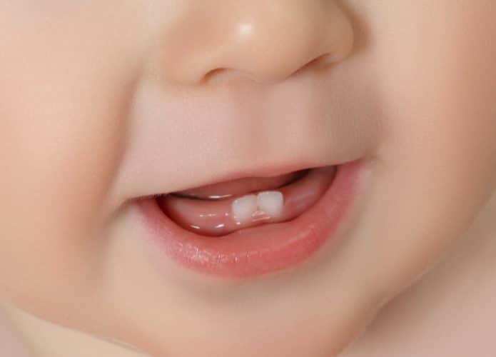 dente-de-leite-695x500