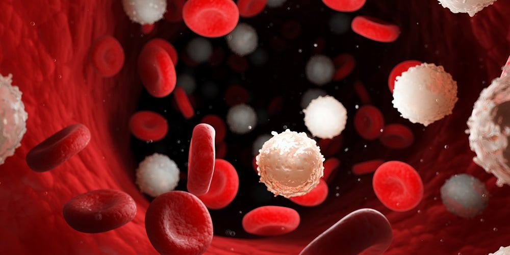leucemia câncer