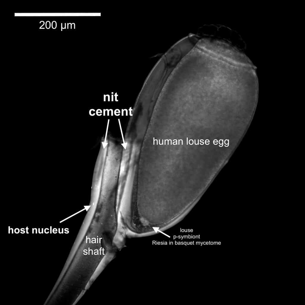 As lêndeas são ovos de piolhos, depositados na cabeça dos humanos e se escondendo entre os cabelos: em múmias antigas, elas se fossilizaram e preservaram material genético de nossos ancestrais