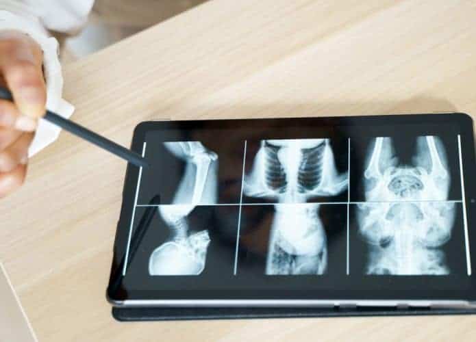 Radiografia-695x500