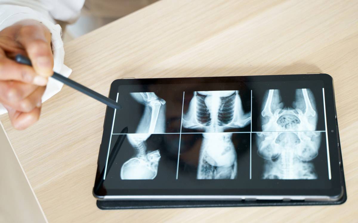 Radiografia