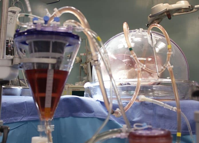 Pesquisa altera tipo sanguíneo para tornar pulmão orgão