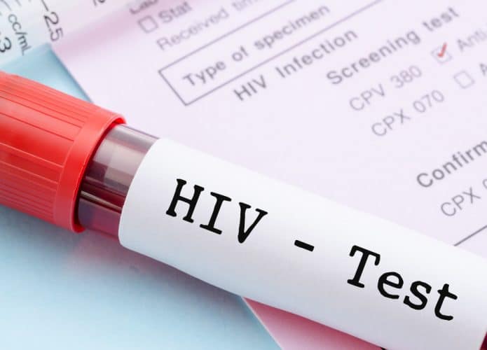 Tubo de teste de HIV