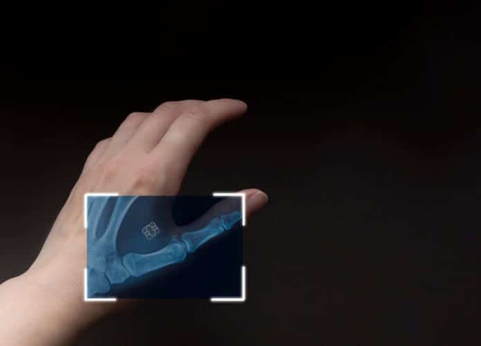 microchip em humanos