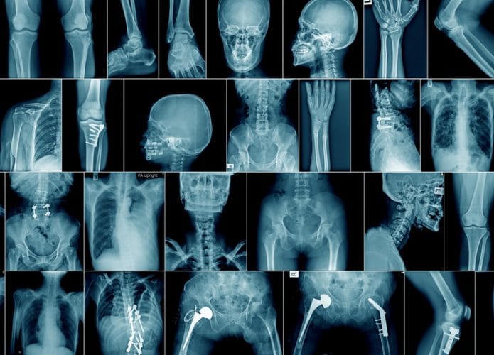 raio-X-radiografia-695x500