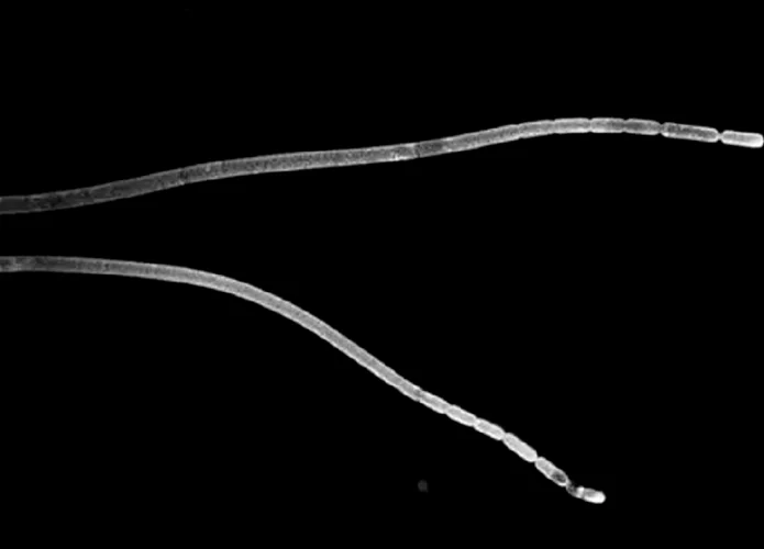 T-magnifica-bacteria-695x500.webp