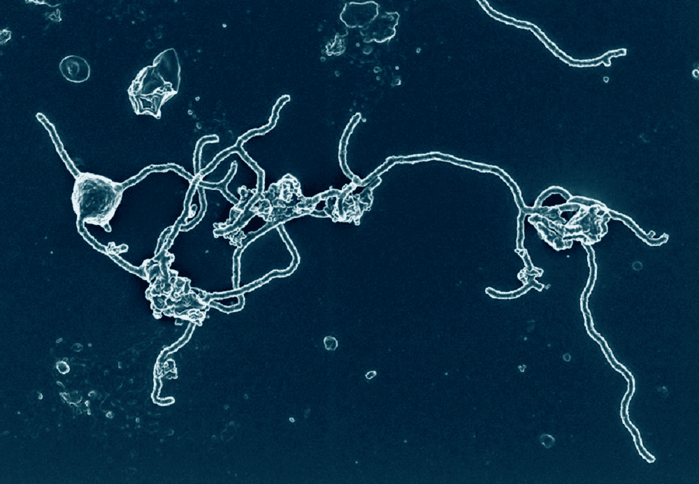 archea.png