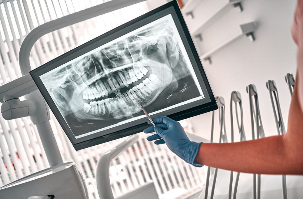 sorriso, odontologia, dentes