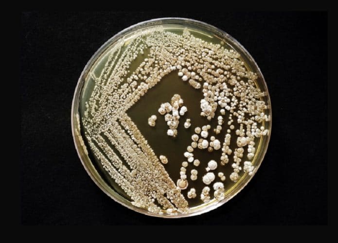 Streptomyces-695x500