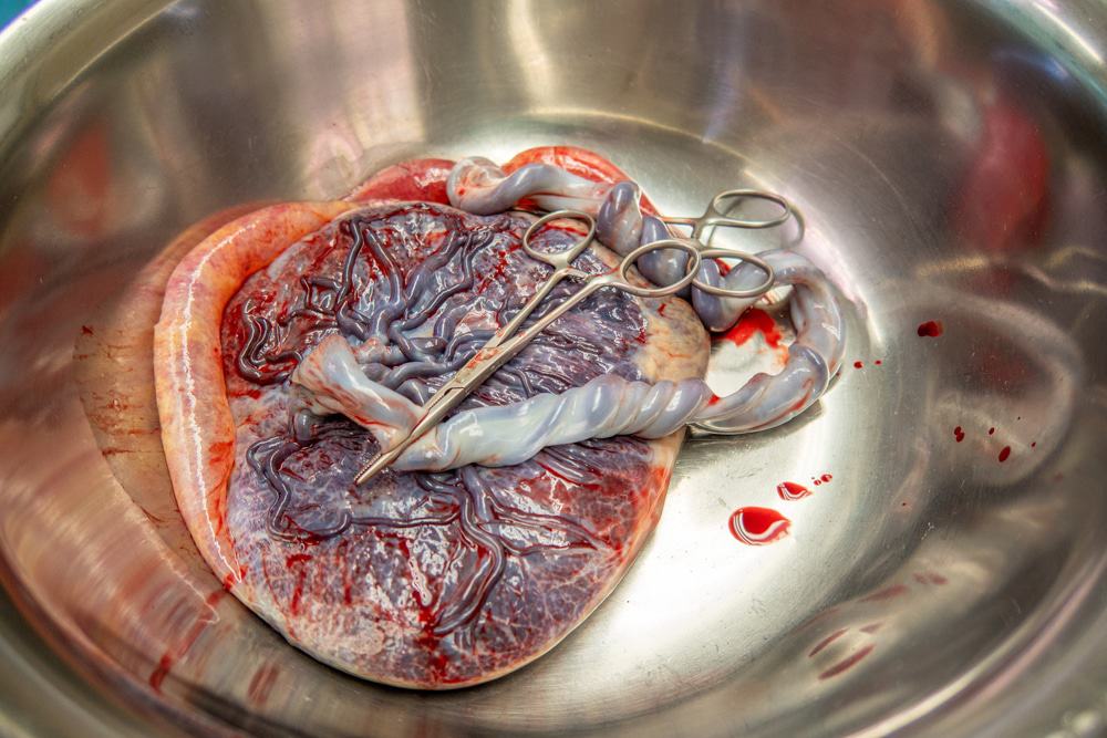 placenta humana