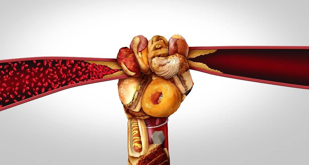 doença cardiovascular artérias