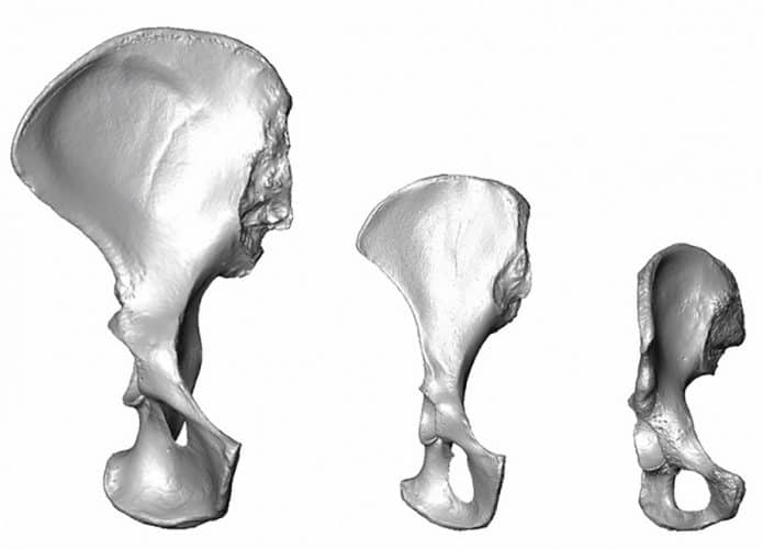 pelvis-695x500