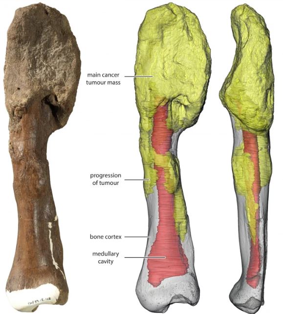 cancer-dinossauro.jpg