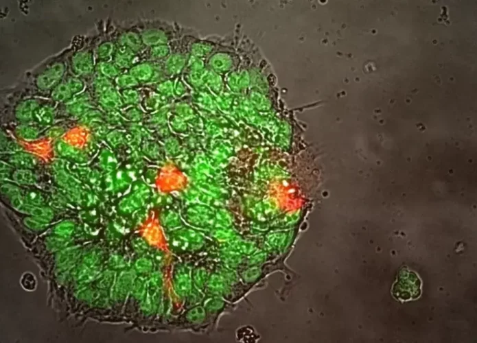 Células-tronco pluripotentes induzidas vista em microscópio. (Credito: Cedars-Sinai)