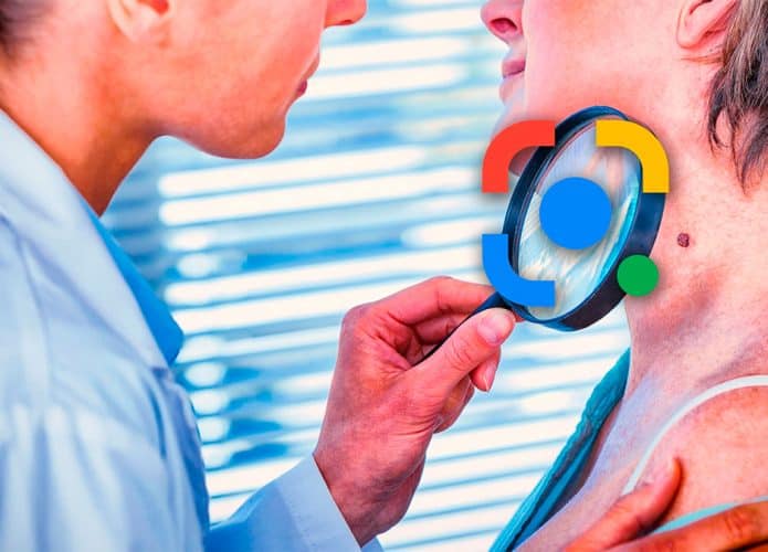 Médico analisando pele de mulher e, sobre sua lupa, está a logomarca do Google Lens