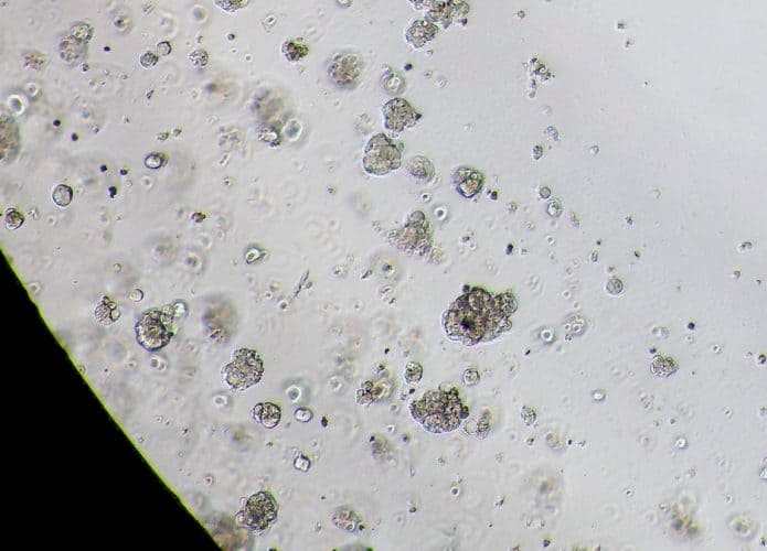 Imagem de microscópio que mostra minitumores em célula