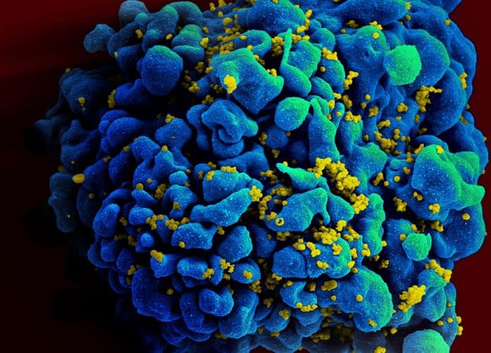 Ilustração digital de célula infectada por vírus HIV