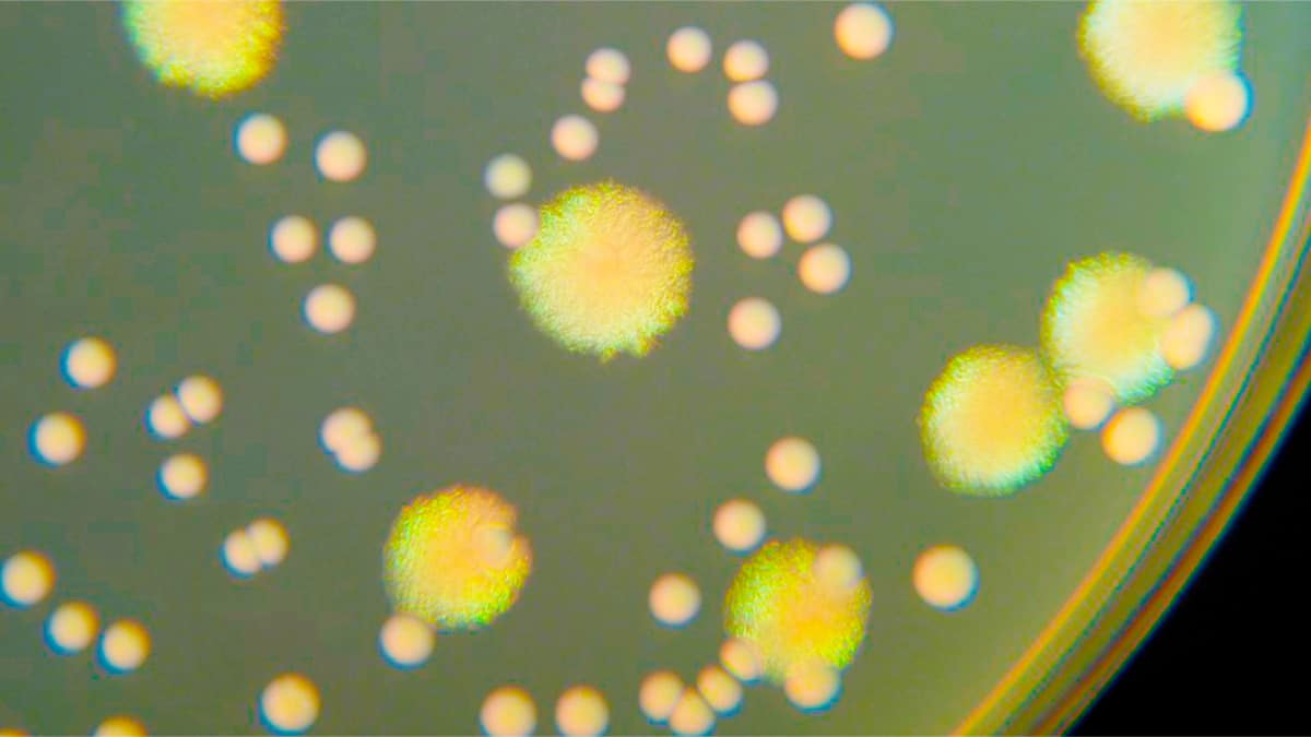 Imagem de microscópio de bactérias