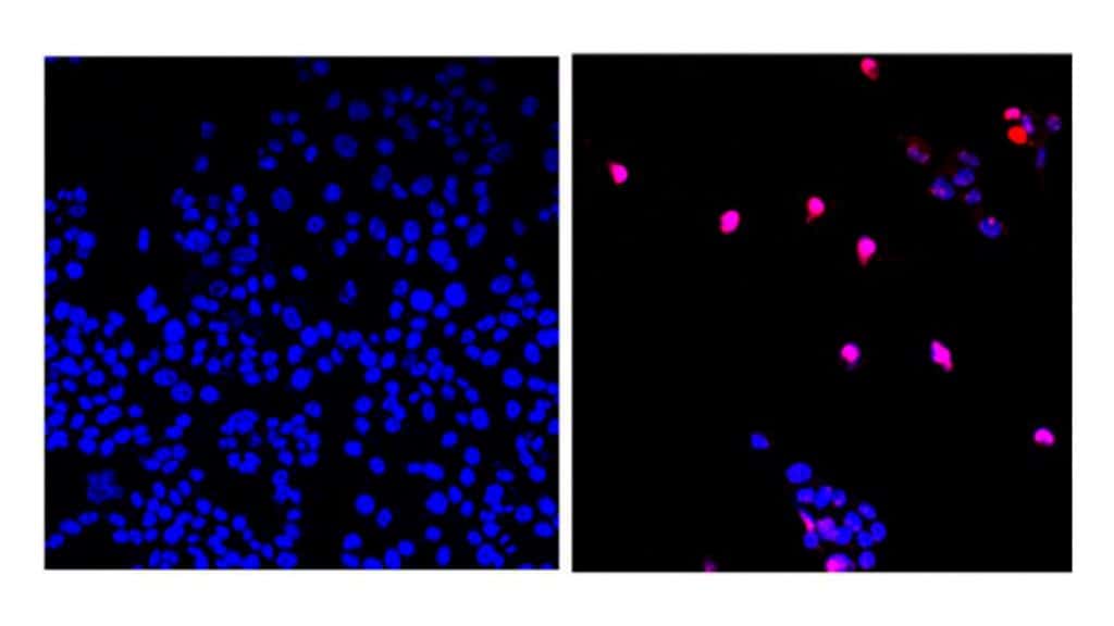 Montagem com imagens de microscópio comparando resultados da nova quimioterapia