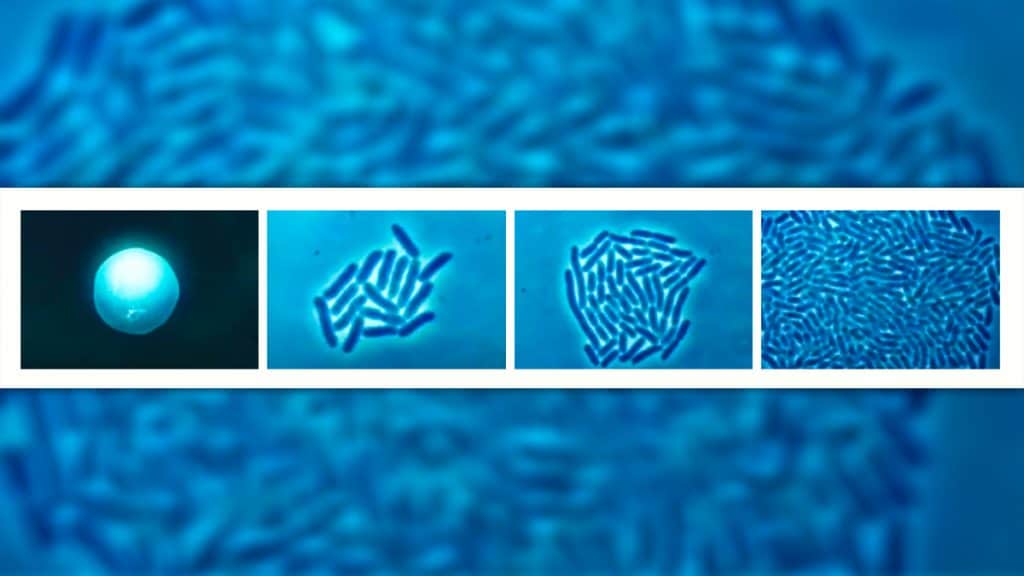 Montagem de imagens de microscópio de bactérias