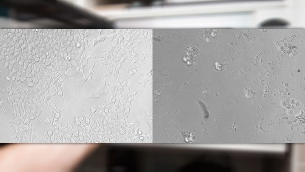 Montagem com imagens de microscópio de partículas de plástico liberadas no micro-ondas